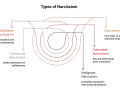Diagrammet visar olika typer av narcissism: Grandios, Kommunal, Sårbar och Malign. Det ger en visuell förklaring av vad som kan menas med narcissist.