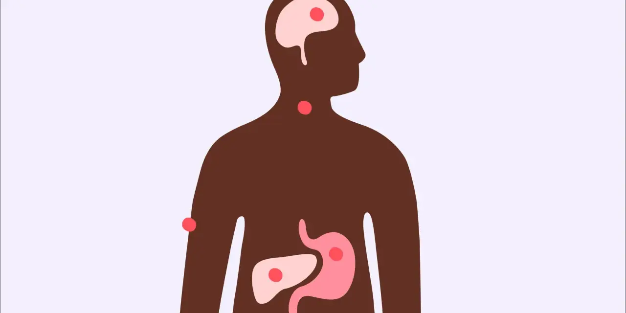 Illustration av en mänsklig silhuett med markerade organ som hjärna, hals, mage och lever. Röda prickar indikerar områden som kan påverkas, vilket väcker frågan: kan man få feber av stress?