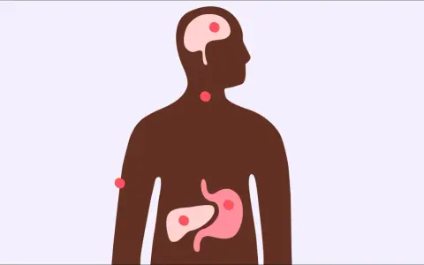Illustration av en mänsklig silhuett med markerade organ som hjärna, hals, mage och lever. Röda prickar indikerar områden som kan påverkas, vilket väcker frågan: kan man få feber av stress?