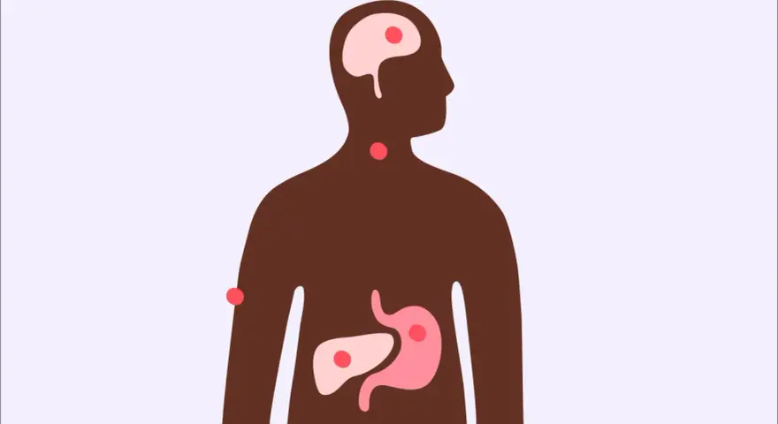 Illustration av en mänsklig silhuett med markerade organ som hjärna, hals, mage och lever. Röda prickar indikerar områden som kan påverkas, vilket väcker frågan: kan man få feber av stress?